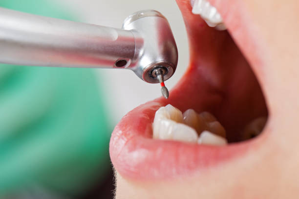 Best Urgent Care for Lost Fillings or Crowns in Waveland, MS